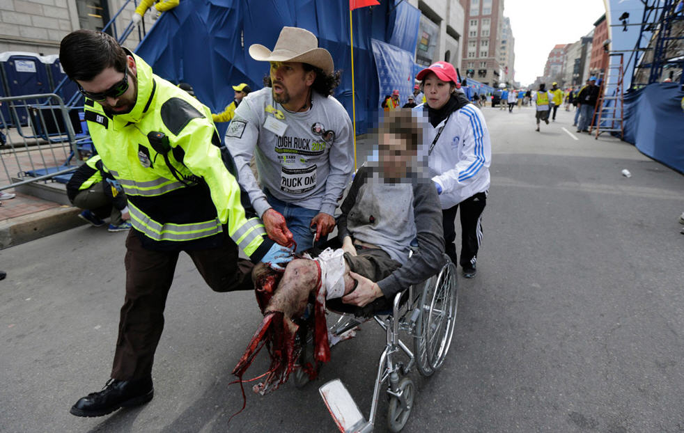 Boston-Marathon-Injured.jpg