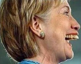 Hillary Clinton OVERBITE